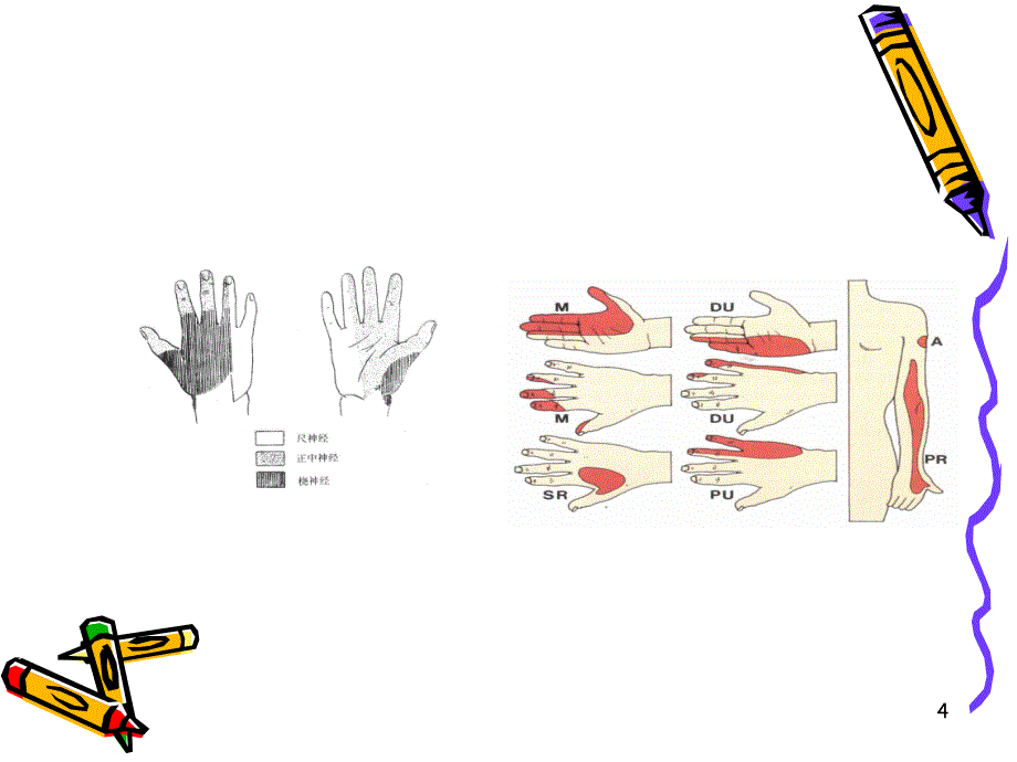 病例尺神经损伤PPT精品医学课件_第4页