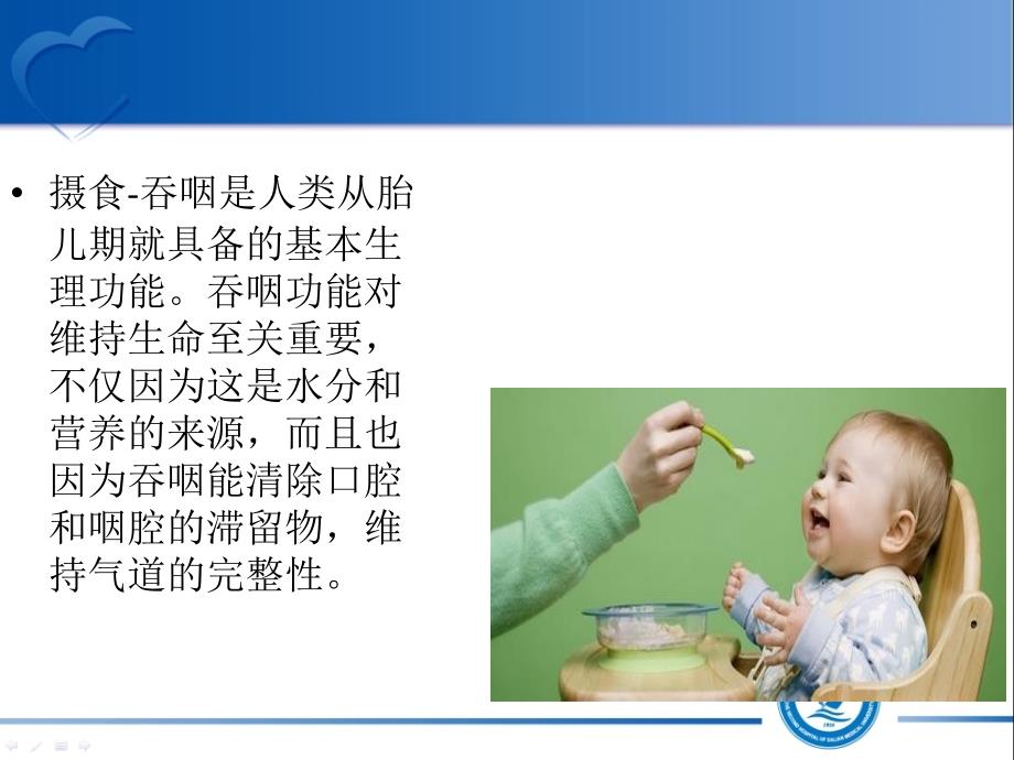 间歇管饲在吞咽困难患者中的应用.ppt_第2页