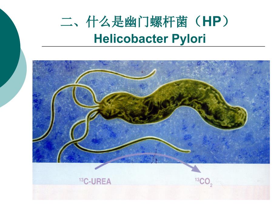 13碳尿素呼气试验.ppt_第4页