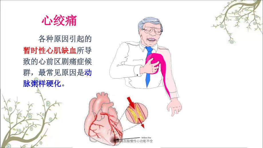 心绞痛调血脂慢性心功能不全_第2页