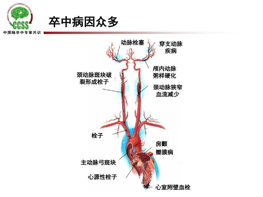 卒中危险因素分层及预防策略_第5页