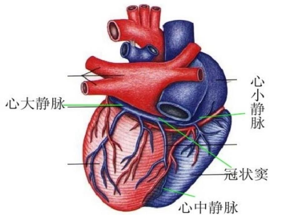 冠状静脉窦无顶综合征ppt课件_第3页