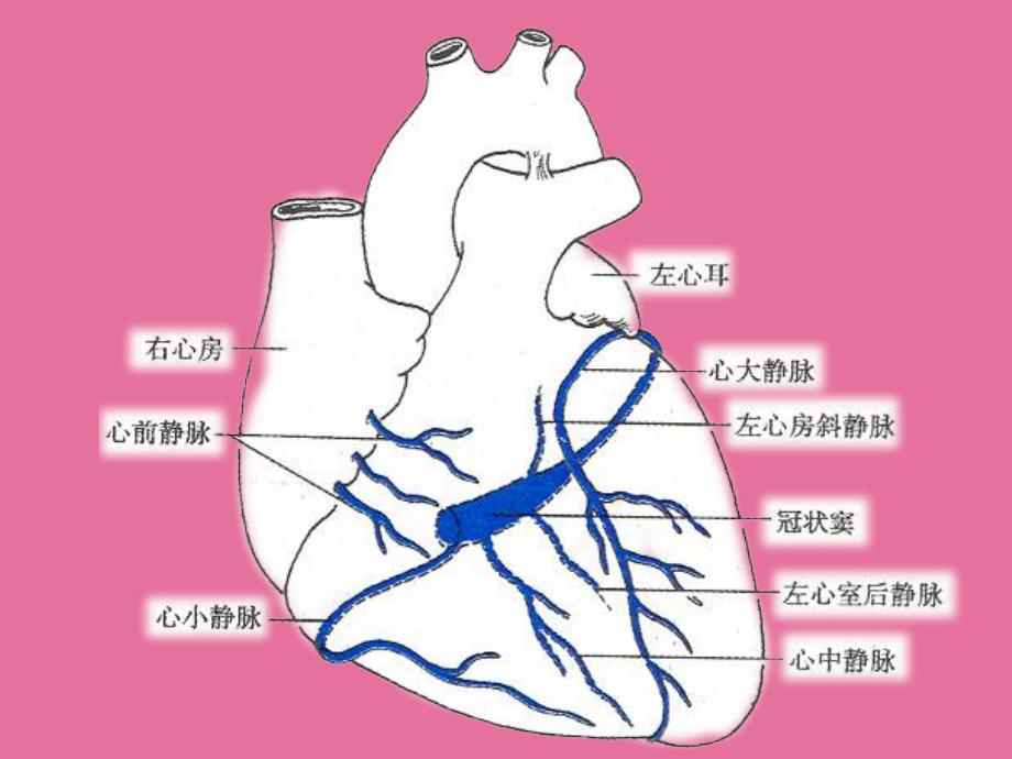 冠状静脉窦无顶综合征ppt课件_第4页