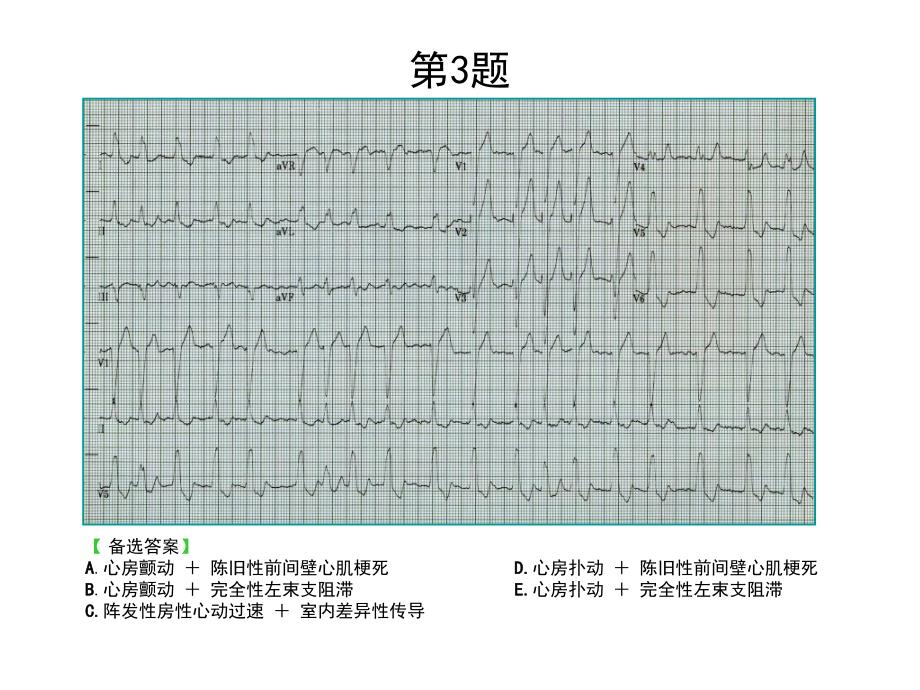 心电图考核题ppt课件_第3页