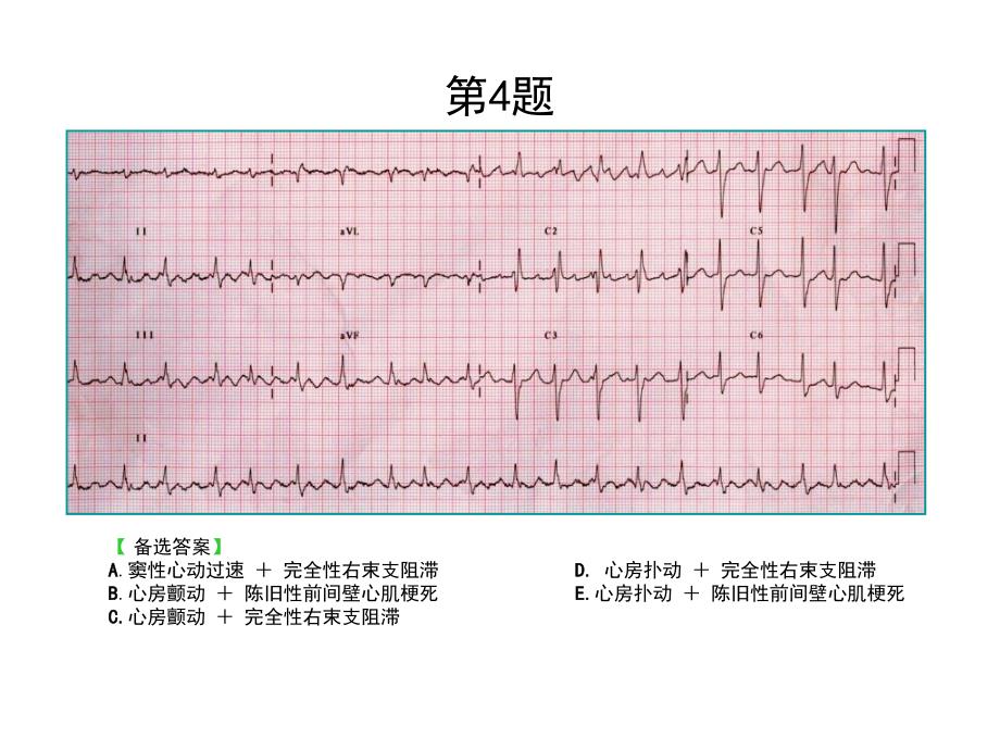 心电图考核题ppt课件_第4页