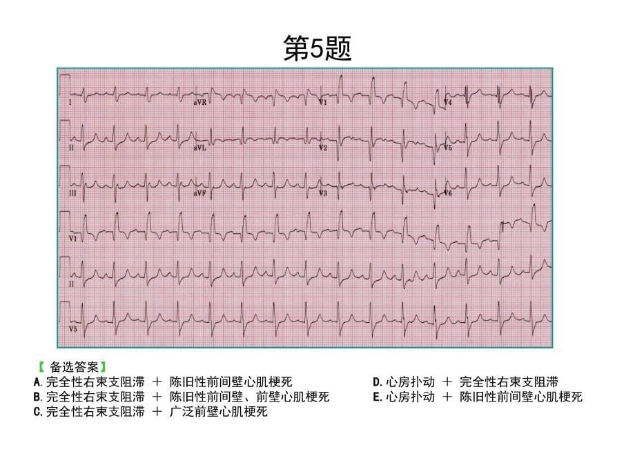 心电图考核题ppt课件_第5页