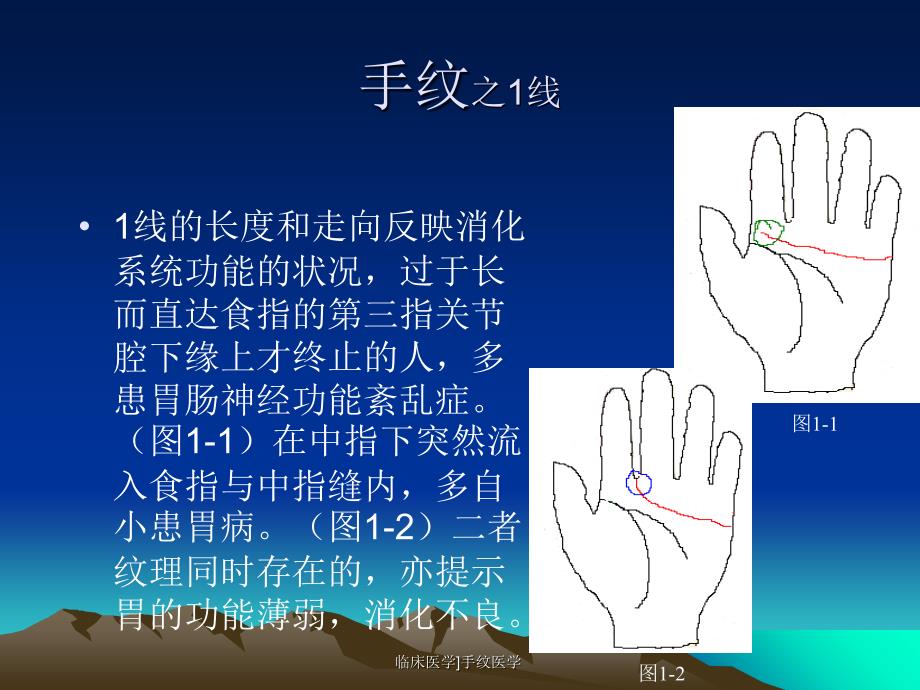 临床医学手纹医学课件_第3页