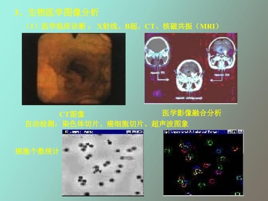 视觉检测技术_第5页