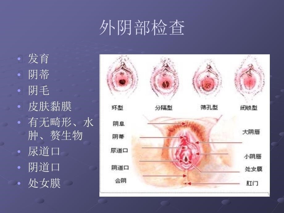 妇产科相关操作培训文档资料_第5页