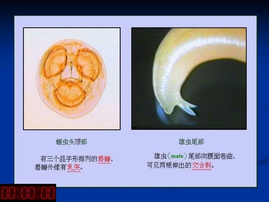 医学寄生虫学：蛔虫_第5页