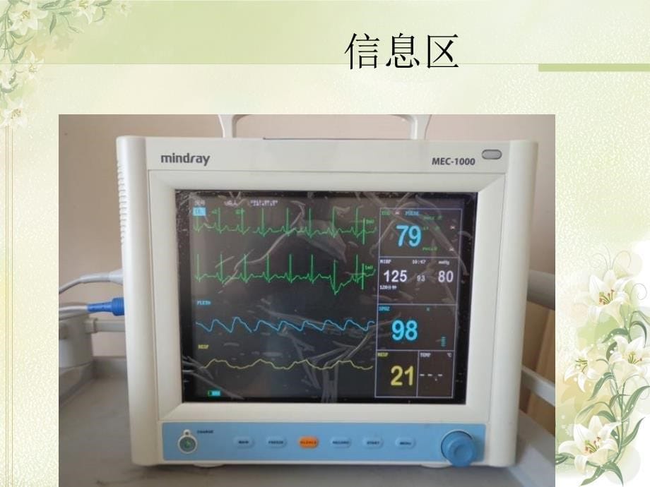 监护仪的简单使用说明_第5页