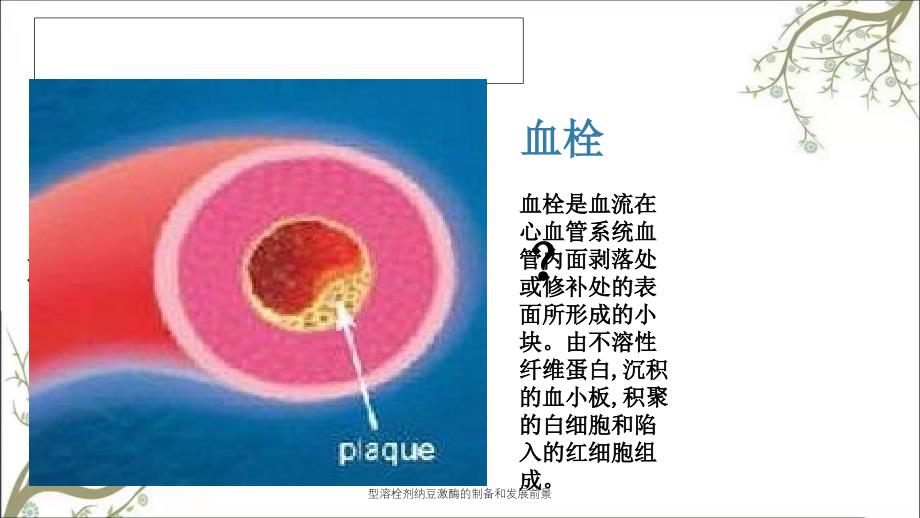 型溶栓剂纳豆激酶的制备和发展前景_第4页