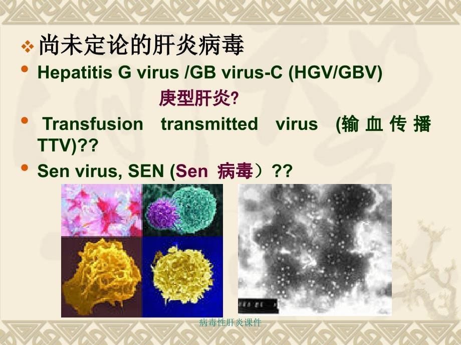 最新病毒性肝炎课件_第5页