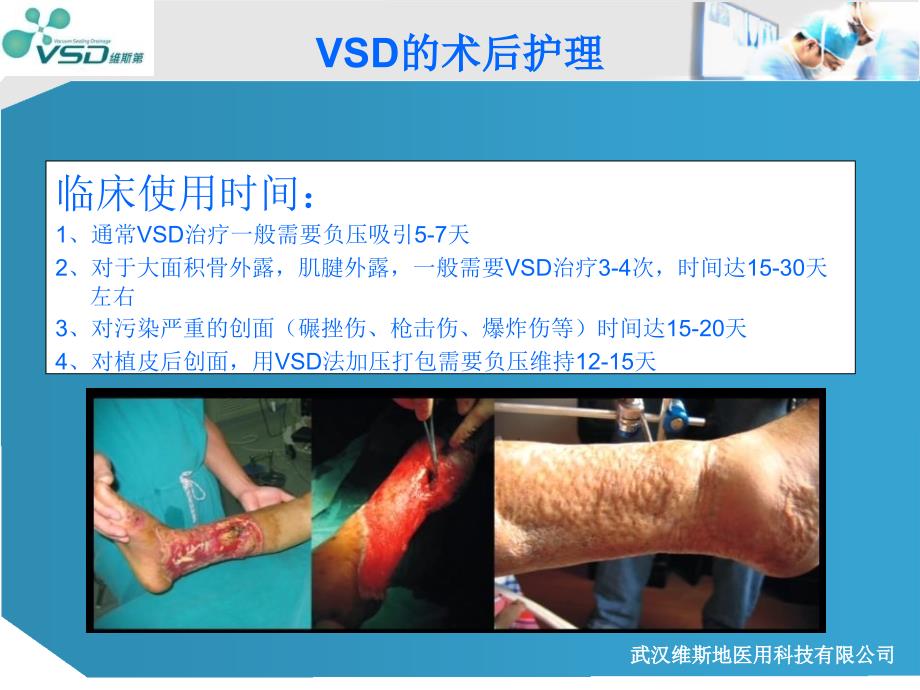 VSD术后护理精选文档_第3页