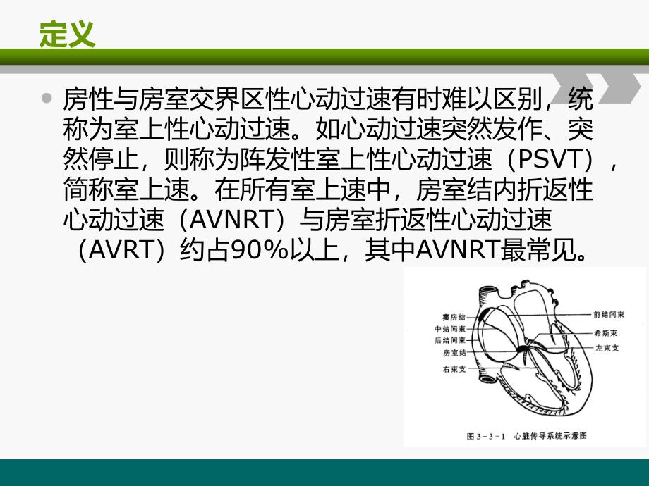 室上速护理查房_第4页