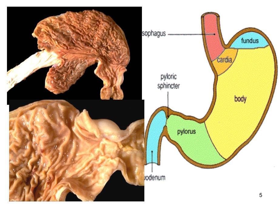 消化系统疾病胃炎ppt课件_第5页