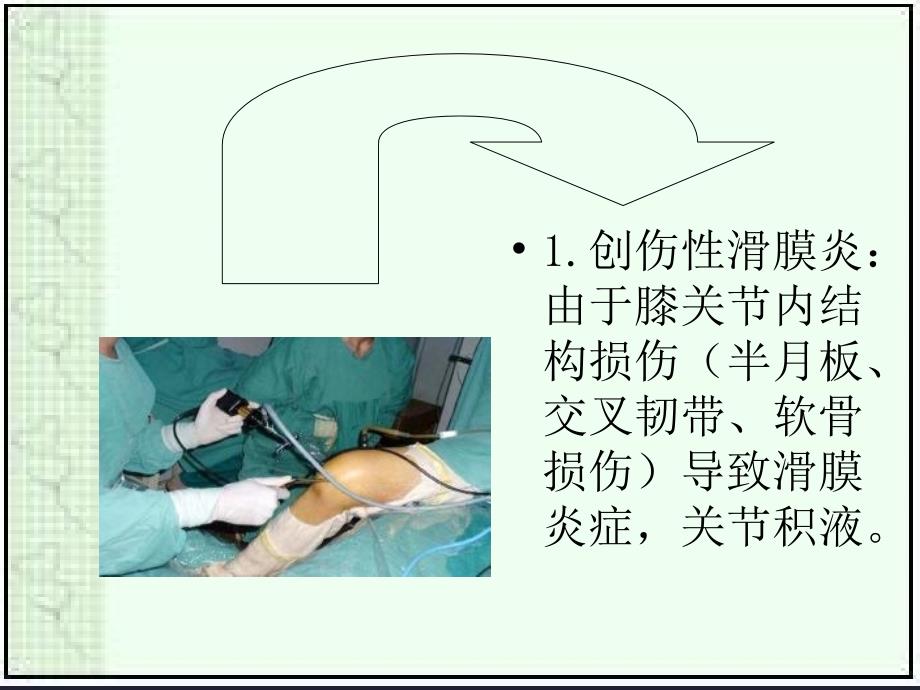 滑膜炎用药指导浅论_第3页