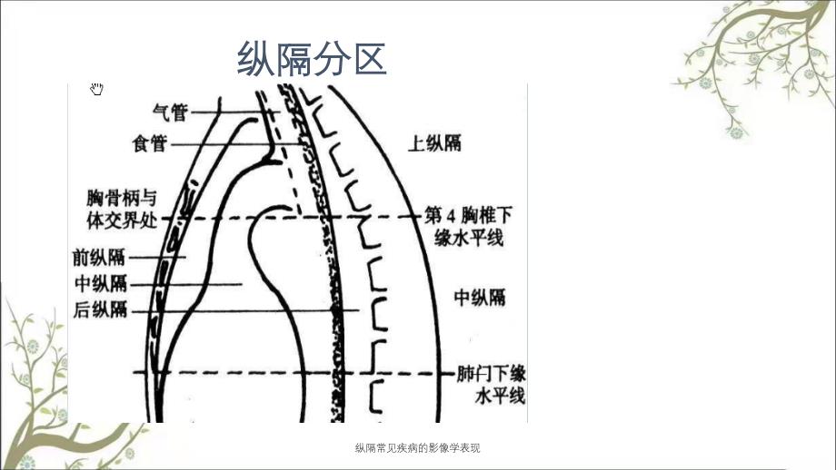 纵隔常见疾病的影像学表现_第3页