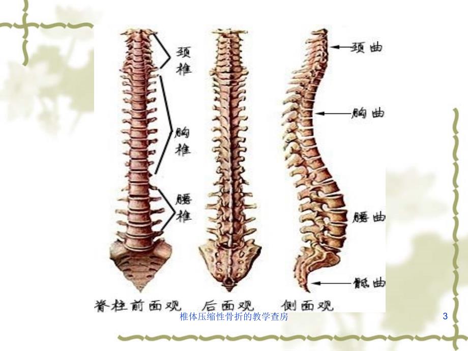 椎体压缩性骨折的教学查房课件_第3页