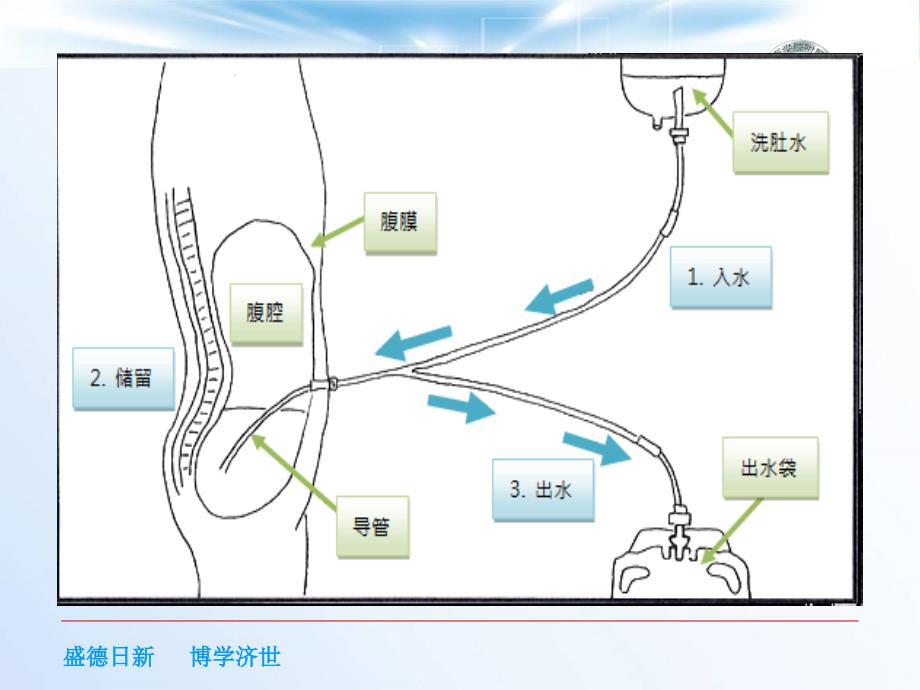 腹膜透析相关护理课件_.ppt_第3页