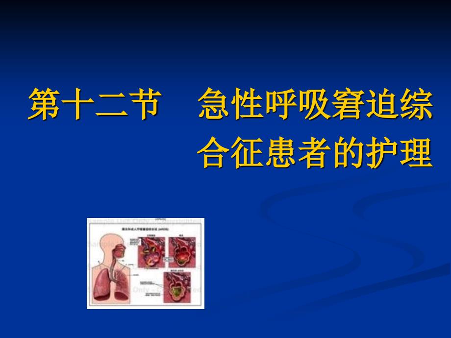 内科护理第二章呼吸系统疾病患者的护理PPT第十二节急性呼吸窘迫综合征患者的护理_第1页