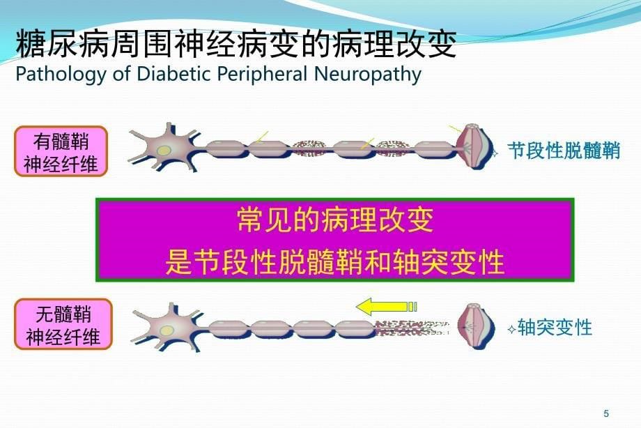 糖尿病周围神经病变课件.ppt_第5页