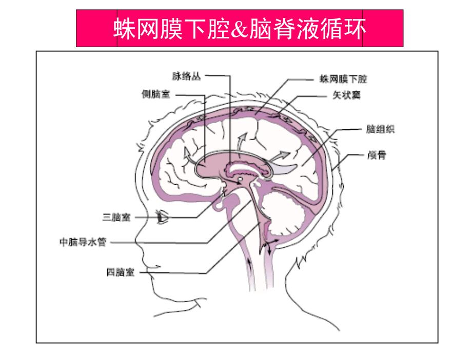 珠江医院蛛网膜下腔出血_第2页