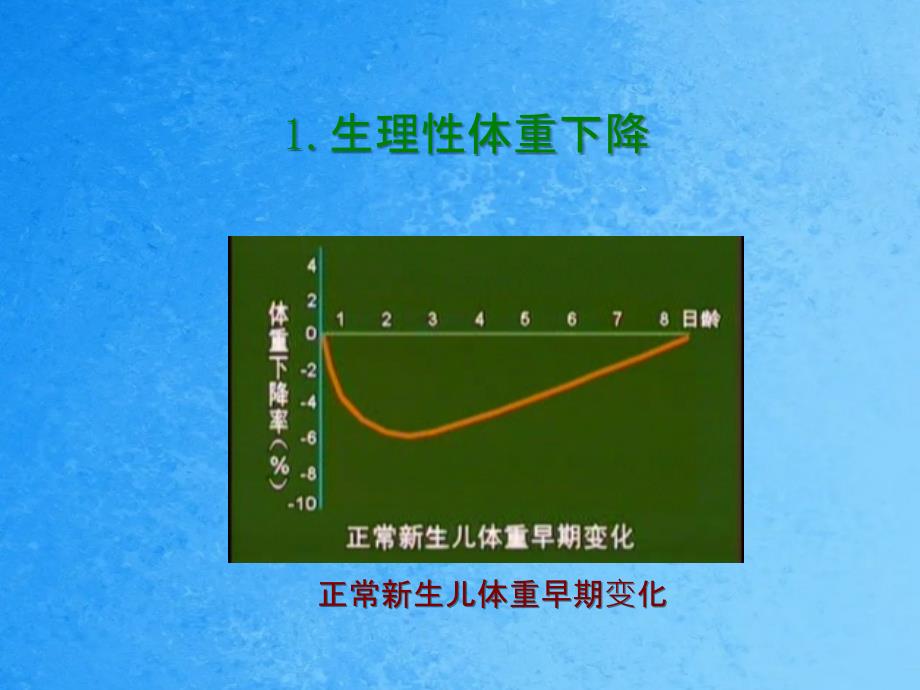 新生儿特殊生理状态及护理ppt课件_第4页