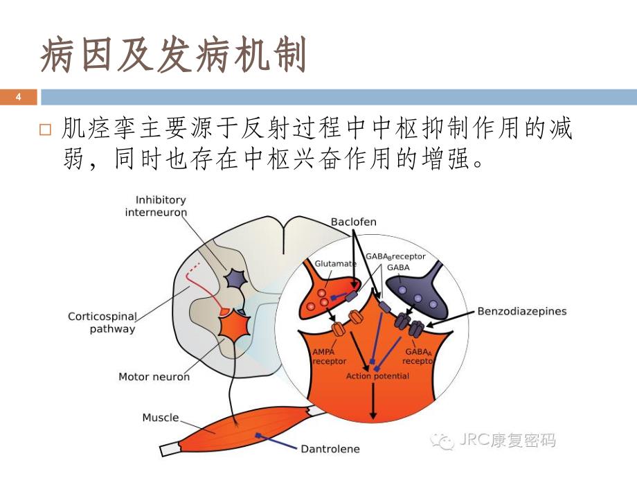 （优质课件）痉挛的评定与治疗_第4页