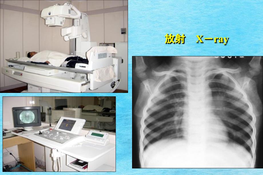 医学影像学总论ppt课件_第2页