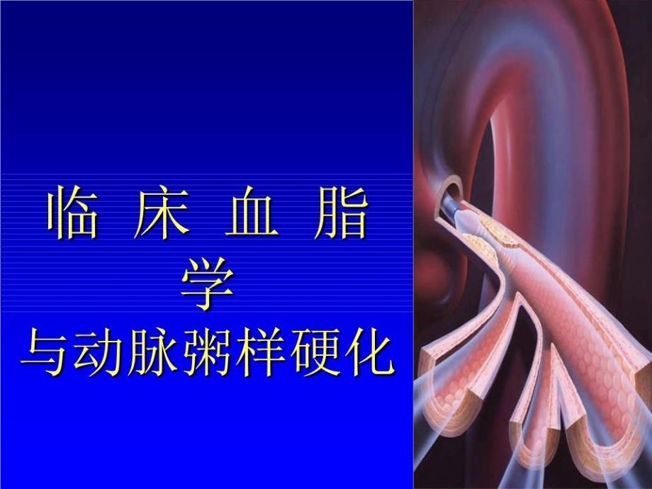 临床血脂学与动脉粥样硬化.ppt_第1页