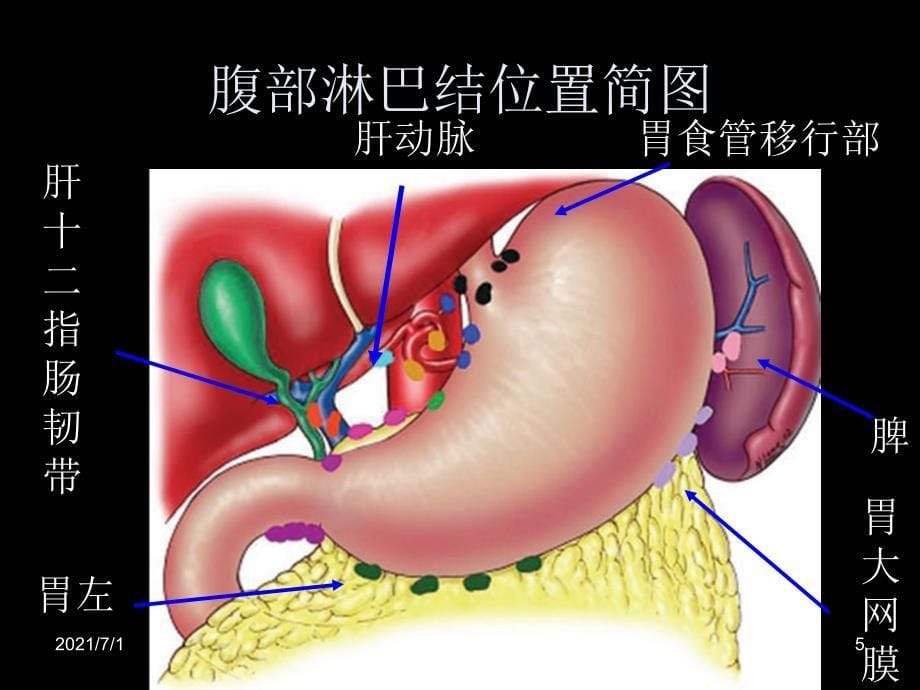 腹部淋巴结分布及转移_第5页