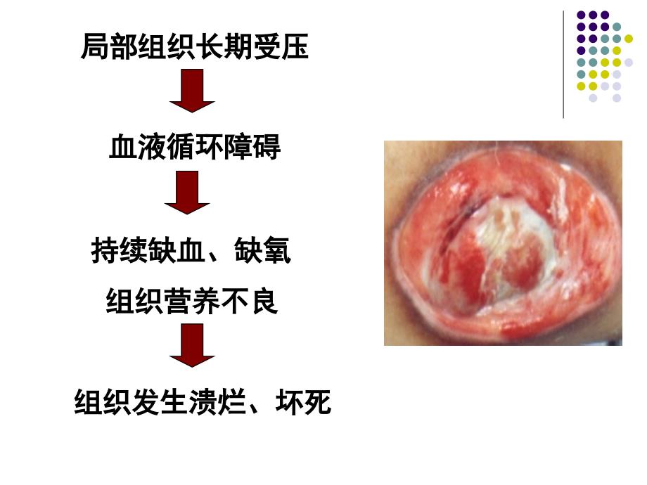 压疮预防及护理PPT_第3页