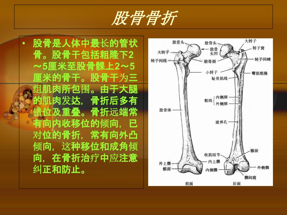 股骨干骨折护理查房_第4页