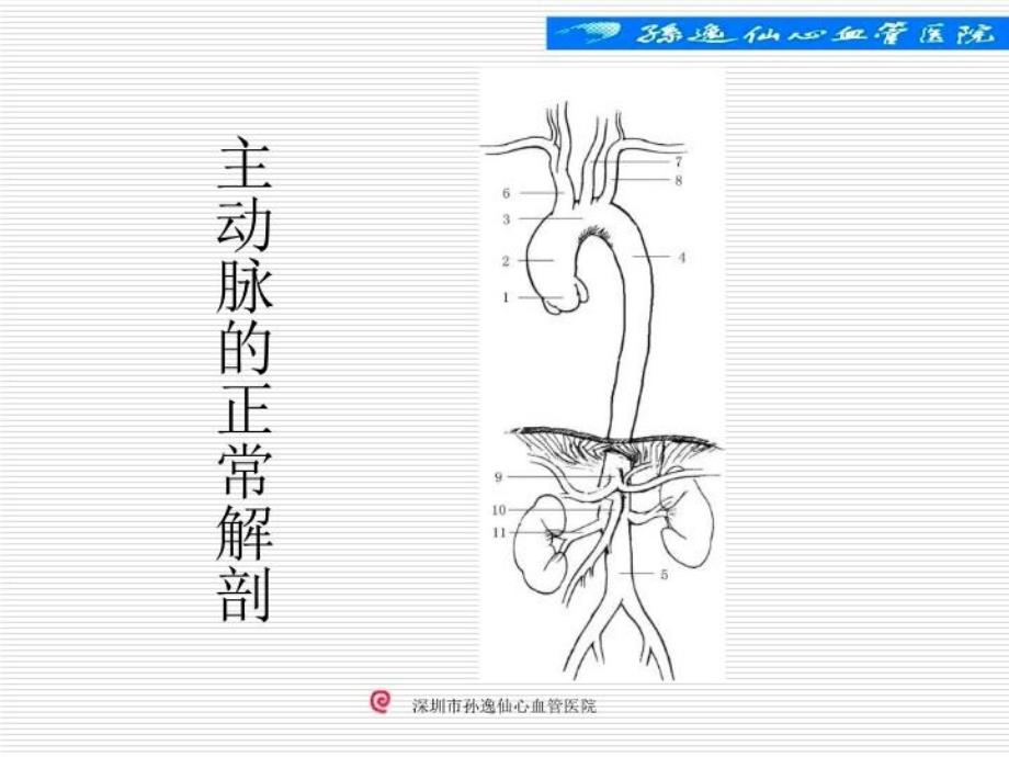 孙氏手术在A型主动脉夹层外科治疗中的应用课件_第3页