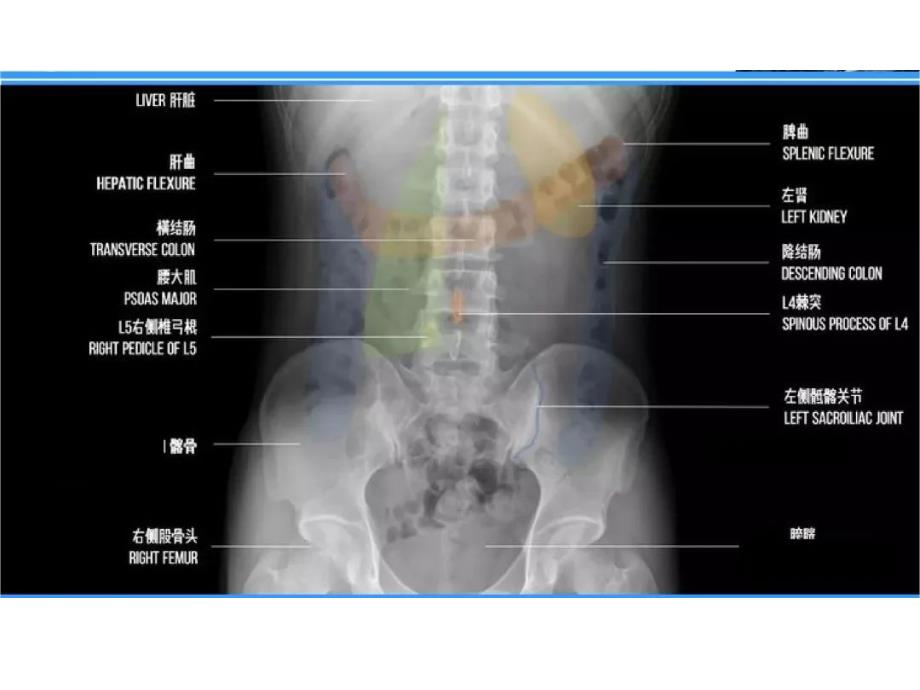 腹部X线摄影检查解剖、体位和技术要求及注意事项_第4页
