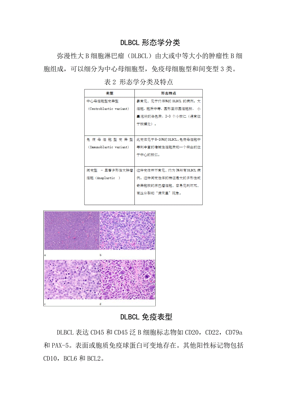 临床弥漫大B细胞淋巴瘤分型、形态学分类、分子遗传学特征、发病机理及治疗_第3页