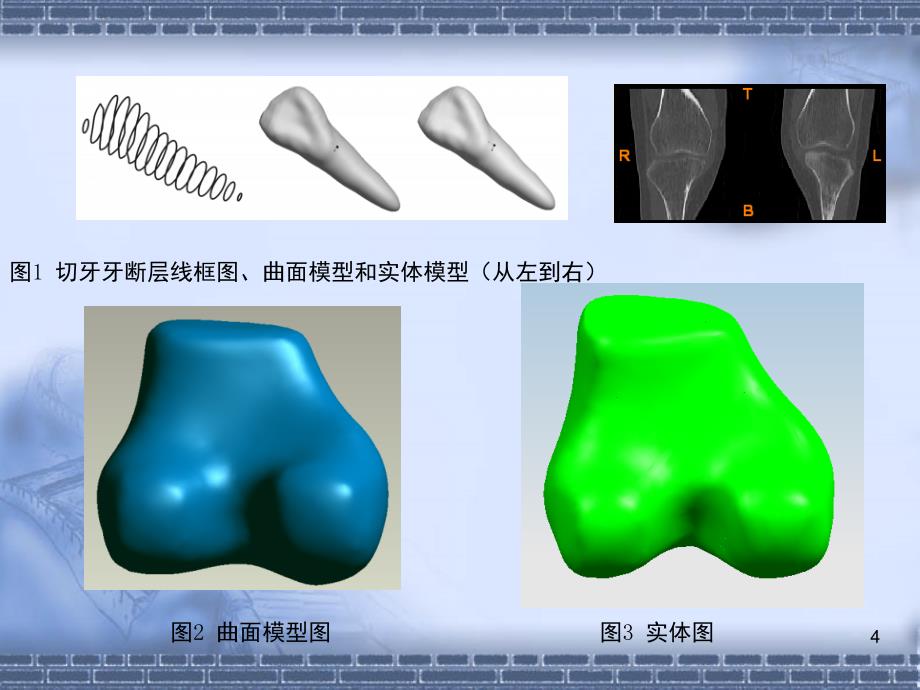 ct图像处理及三维重建的综述文档资料_第4页