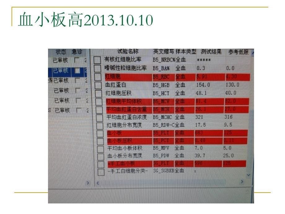 一例血小板异常升高的类风关_第5页