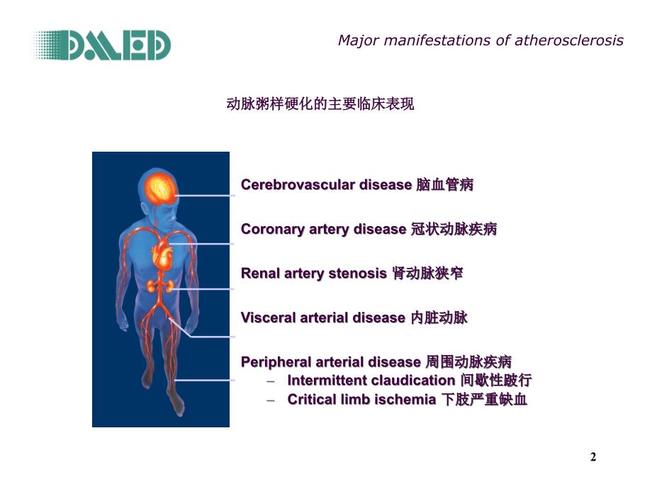 ABI踝臂指数检查ppt课件_第2页