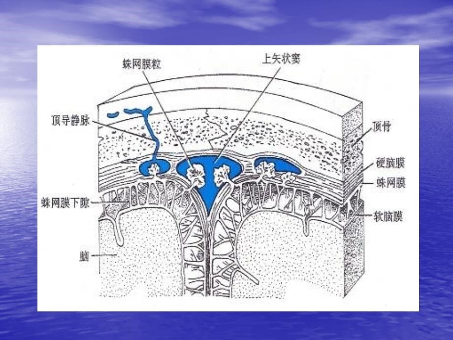 脑积水的影像诊断教学提纲_第5页