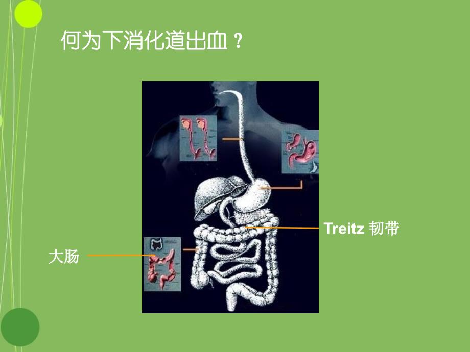 下消化道出血的诊治_第2页