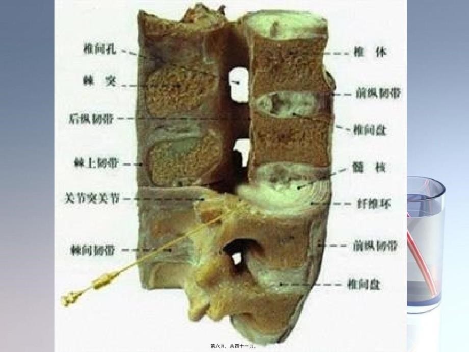 202X年腰椎间盘突出症骨科教学查房08278_第5页