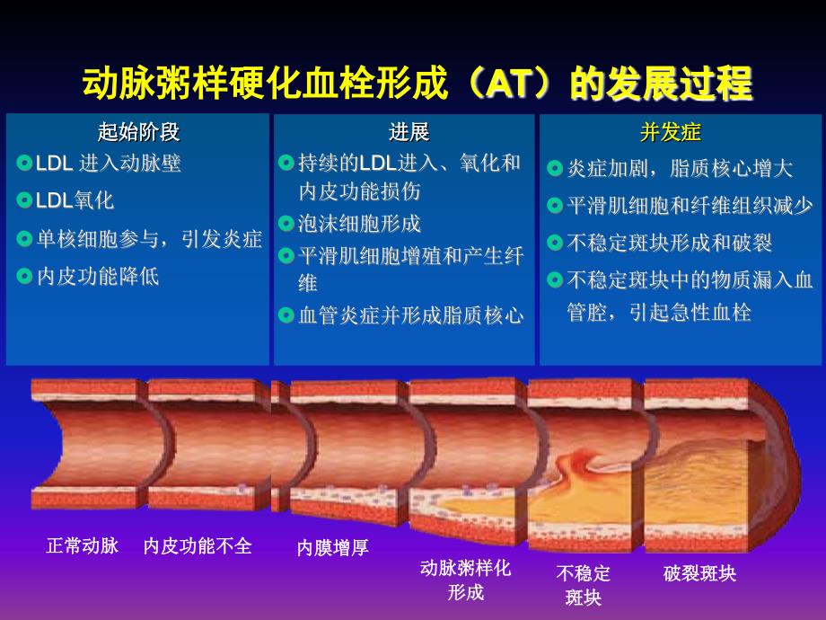 急性冠脉综合征的当代新理念(讲稿)1课件_第2页