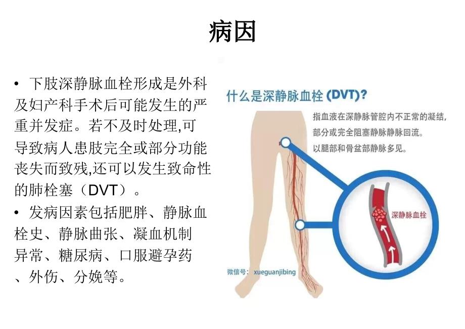 深静脉血栓预防护理ppt课件_第4页