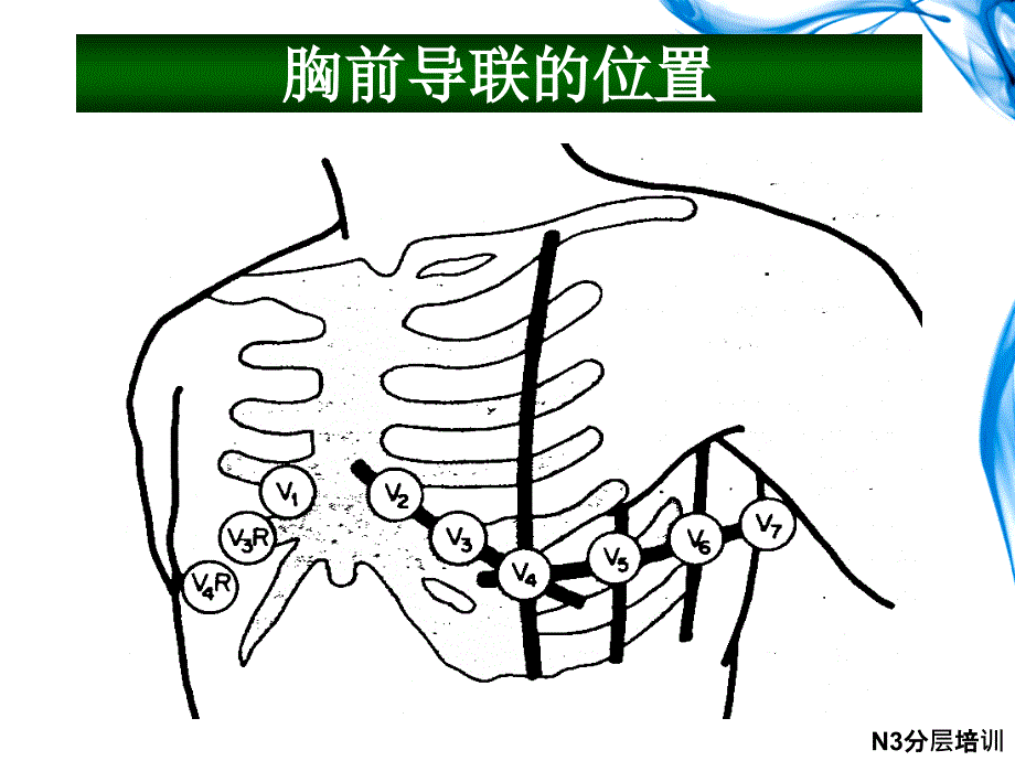 心电图的临床应用_第4页