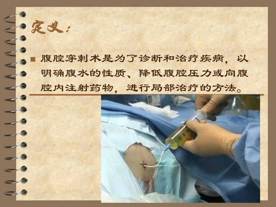 腹腔穿刺术及护理_第2页