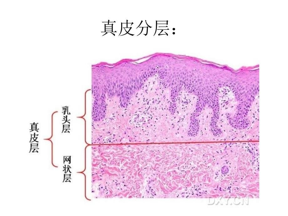 肿瘤诊治技术-皮肤肿瘤.ppt_第5页