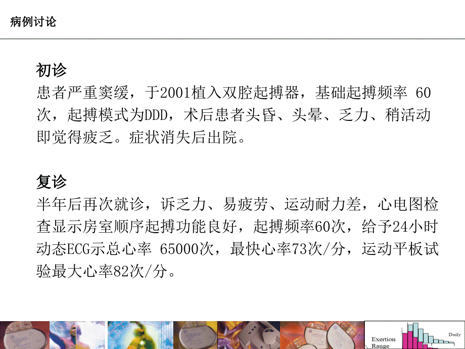 变时性功能不全幻灯片_第2页