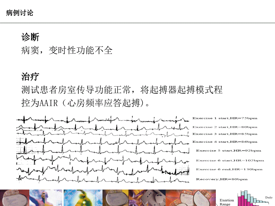 变时性功能不全幻灯片_第3页